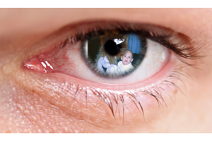 oeil droit o